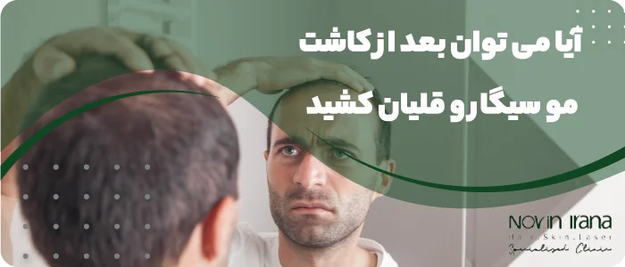 چه مدت بعد از کاشت مو میتوان سیگار کشید